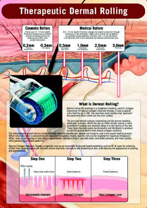 Therapeutic Dermal Rolling