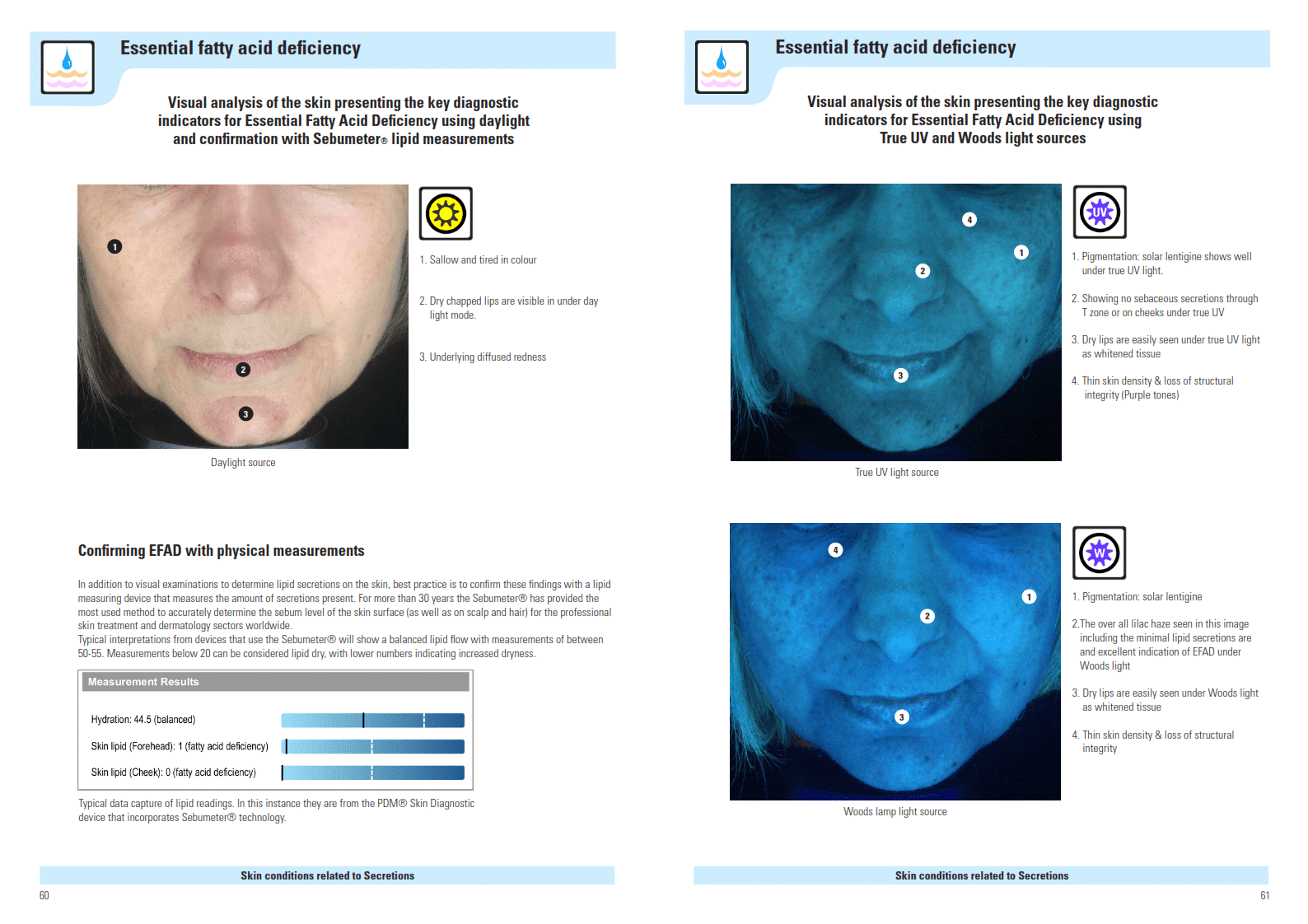 Sample pages from the Visual Skin Analysis Diagnostic Indicator Guide
